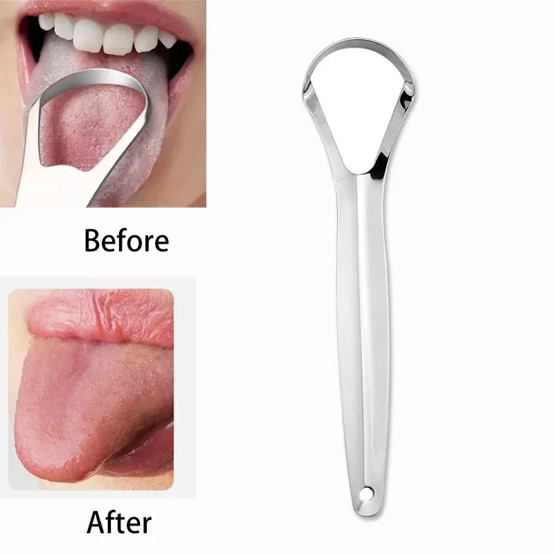 Tongue Scraper Metal - 口臭舌コーティング舌スクレーパーステンレス鋼クリーニングリムーバー舌コーティングブラシ舌をこすり落とす口腔衛生ツール