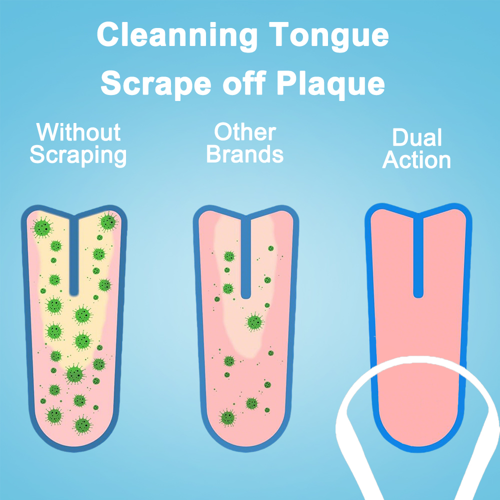 ステンレス鋼舌クリーナー 3 モデル 錆びにくい耐久性のある - Tongue Scraper Metal のレビューと価格