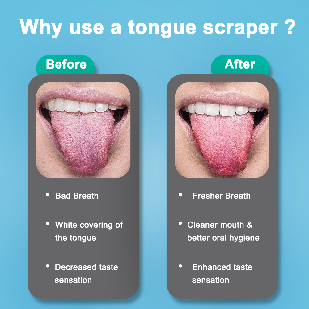 ステンレス鋼舌クリーナー 3 モデル 錆びにくい耐久性のある - Tongue Scraper Metal のレビューと価格