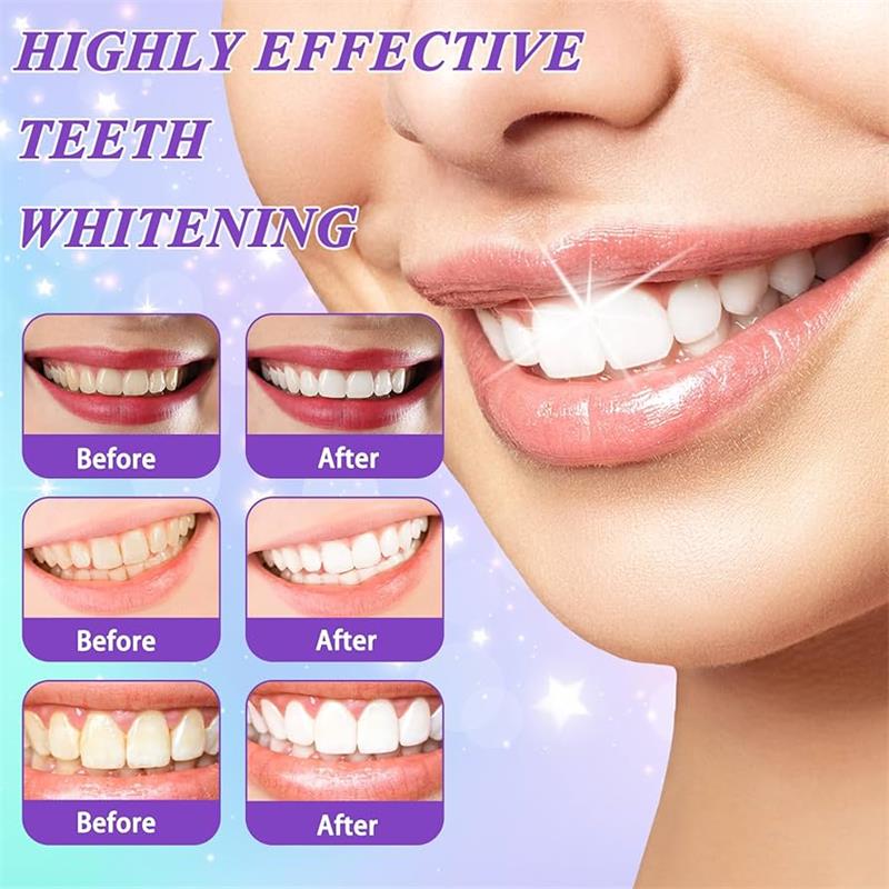 9D パープル歯磨き粉ムース 黄ばんだ歯の汚れ除去用集中ステ - Teeth Whitening Cream のレビューと価格