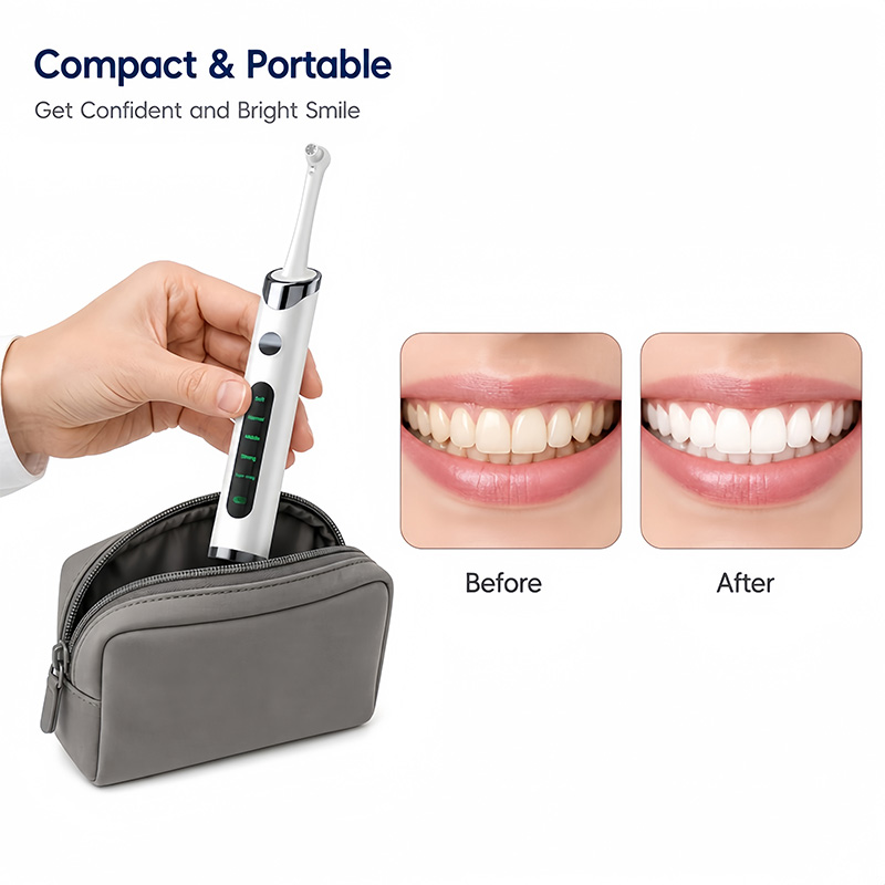 歯磨きポリッシャー歯のホワイトニングキット、歯の洗浄とホワイ - Teeth Whitening Kit With Light のレビューと価格