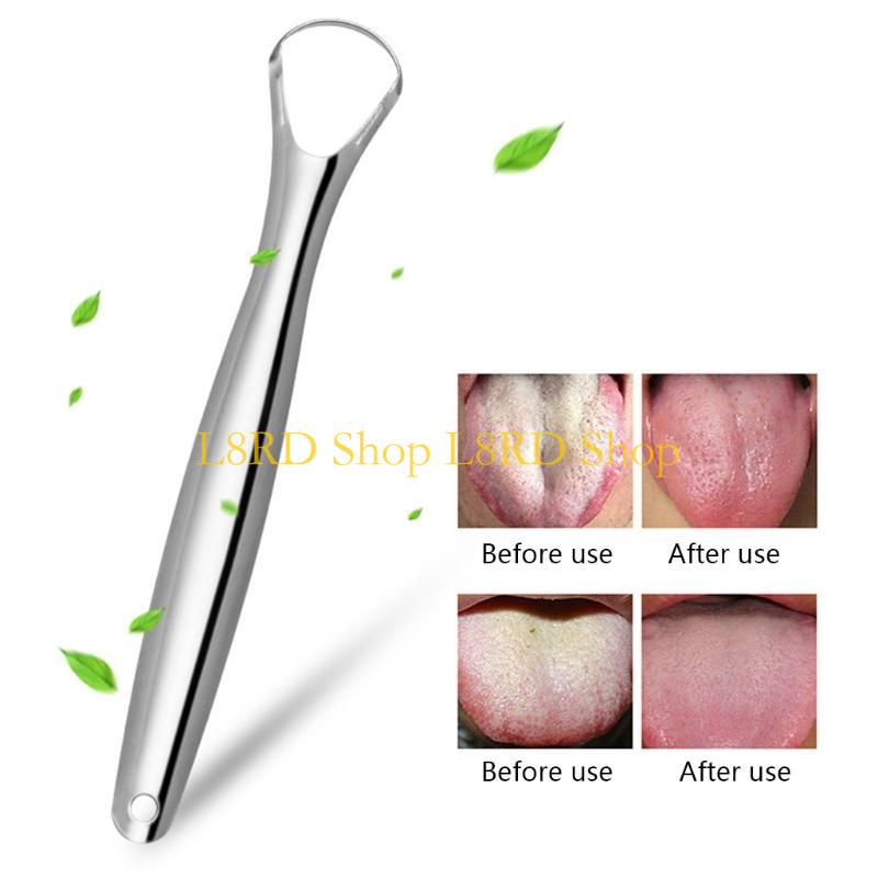 L8RD ステンレス鋼舌スクレーパー金属口腔衛生フレッシュブ - Tongue Scraper Metal のレビューと価格