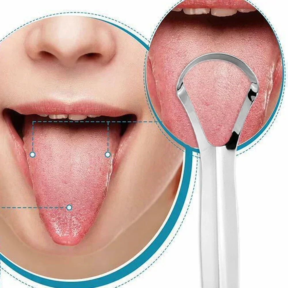 1-20個入り舌クリーナー、ステンレス製舌クリーナー、プロ仕 - Tongue Scraper Metal のレビューと価格